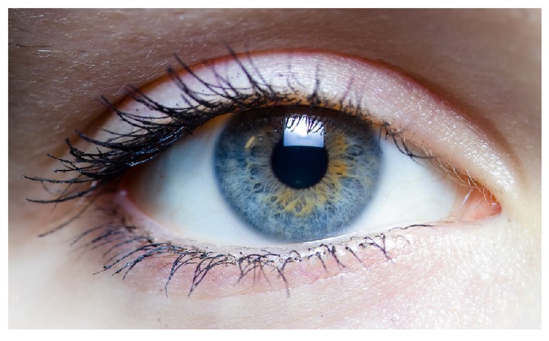 Causas y remedios de la irritación de los ojos y la conjuntivitis