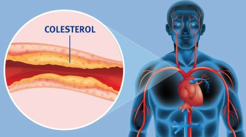 ¿Sabes cuales son los niveles adecuados de colesterol y cómo bajar el colesterol malo?