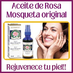 Aceite Rosa Mosqueta, regenera la piel