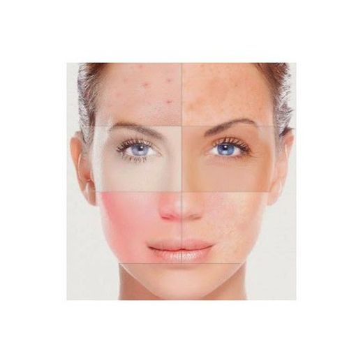 Tratamiento facial